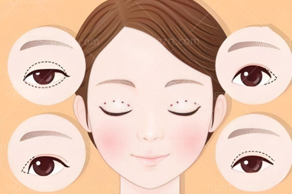 北京黄罡医生个人资料简介:面吸脂手术/修复双眼皮技术与取异物能力大揭秘