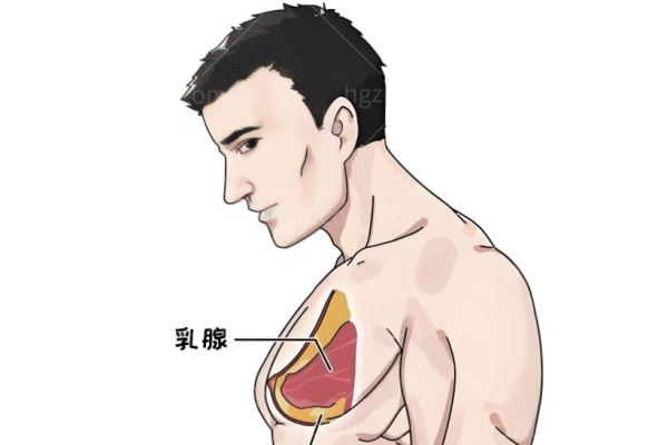 男生假体隆胸技术好吗