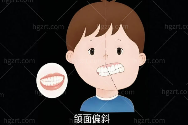 肖林正颌手术排队多长时间?做正颌3D导航价格透明且性价比高可预约