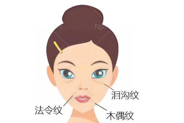 李晓东面部提升手术水平高?位置隐蔽切口小不像传统拉皮那样一刀切