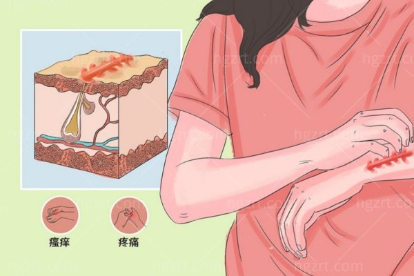 昆明昆大疤痕医院怎么样