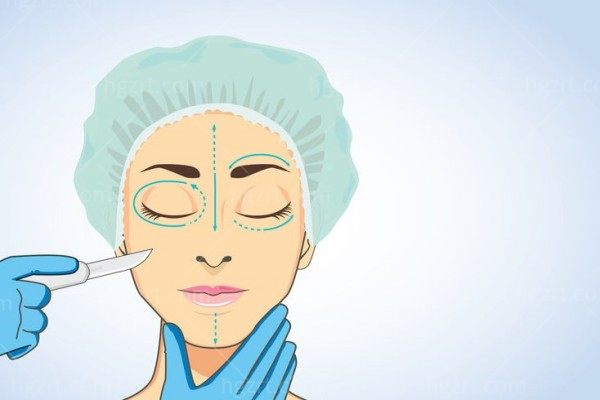 曹林医生做双眼皮多少钱
