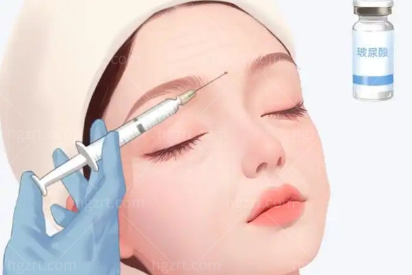 乔雅登极致贵还是雅致贵?区别在哪?多久能完全吸收?要间隔多久打?