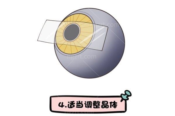 刚做完手术，人工晶体手术后多久可以游泳？