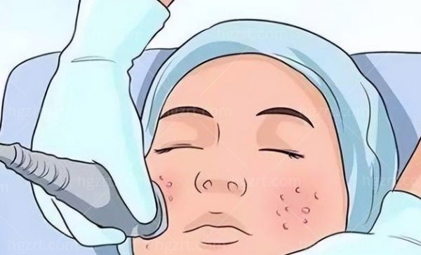 丝美妮水光系列价格