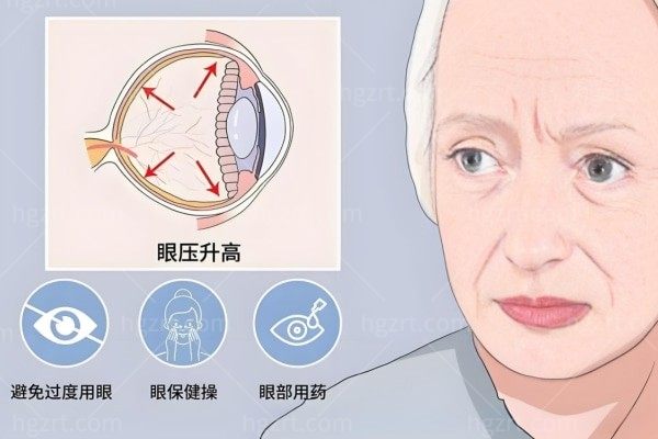 青光眼老人注意谨慎喝水的原因