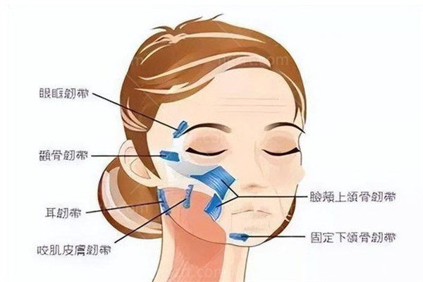 硅胶弹力线面部提升的利与弊大揭秘！5年长效抗衰值不值？