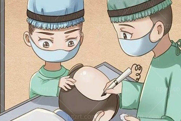 乌鲁木齐丝倍森植发多少钱