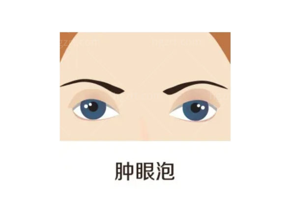 沈阳杏林张莹莹拉双眼皮技术靠谱吗