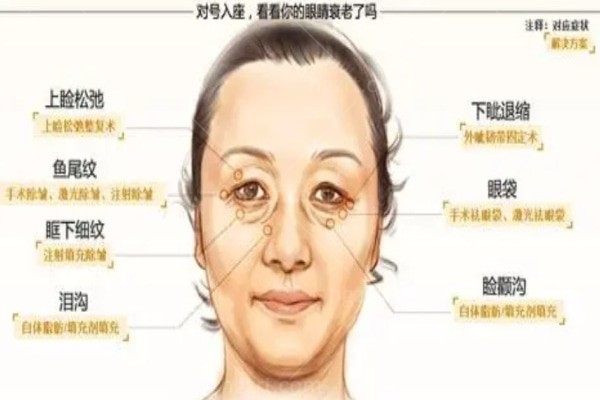 欧赛斯眼周肽打一疗程管多久？体质不同影响大吗