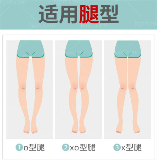o型腿成年了还能矫正吗