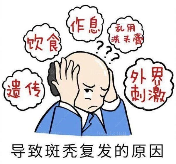 斑秃的原因和治疗方法