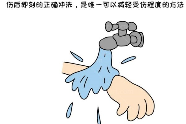 烧烫伤一度、浅二度、深二度、三度怎么区分