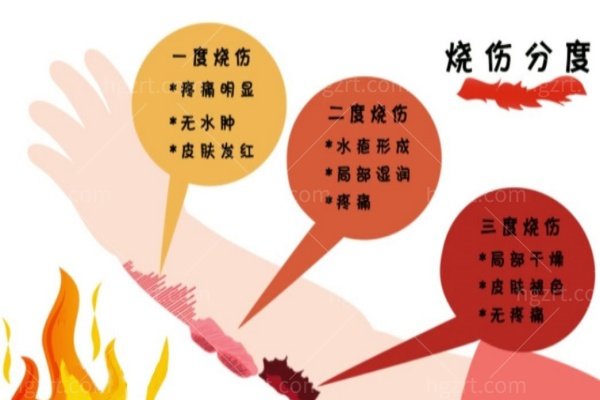 揭秘烧烫伤一度、浅二度、深二度、三度怎么区分？看图自测不误判