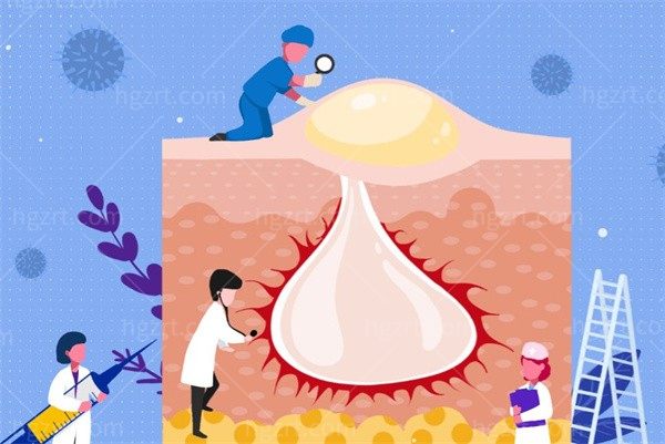 舒敏之星停了会反弹么？能修复皮肤屏障吗