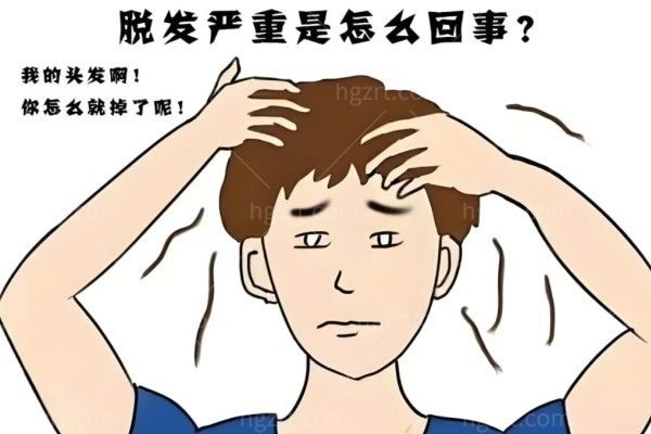 2025国内植发正规医院排名前十名:碧莲盛/大麦微针/雍禾榜单前三植发技术可靠可兜底
