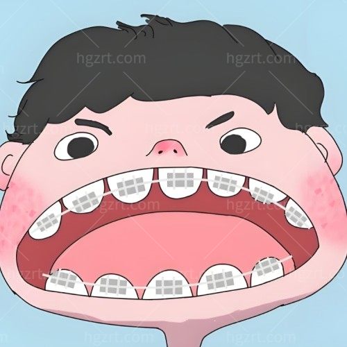 想给孩子做矫正，兜齿矫正会反弹吗？