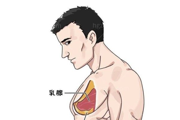 男性乳头大请问做乳头缩小手术大概需要多少钱？