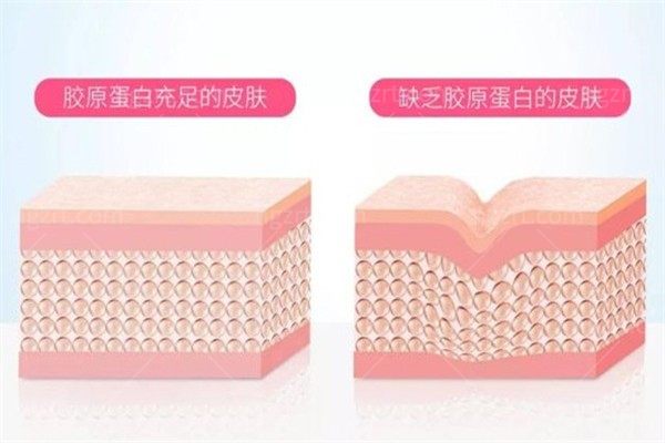 近期热门的三型胶原蛋白有哪些品牌？