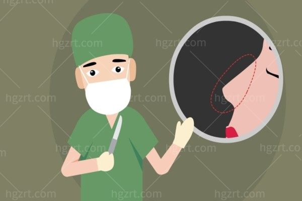 骨胶原隆鼻可以维持多久？