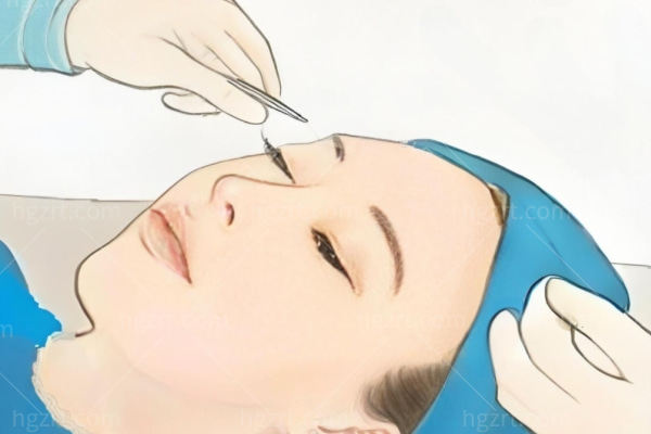 广州眼修复医院排名前十:眼修复切口小/出血少/性价比高的是这几家