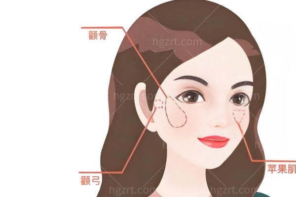 何照华磨骨技术怎么样?坐诊北京联合丽格颧骨内推/下颌角截骨/颧骨降低收费合理口碑好