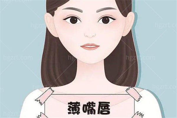 瑞蓝2号玻尿酸丰唇成效好吗