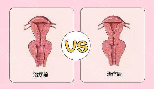 北京紧缩针多少钱一针
