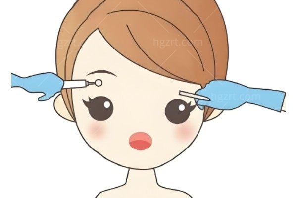 做完提眉手术后多长时间可以化妆呢？