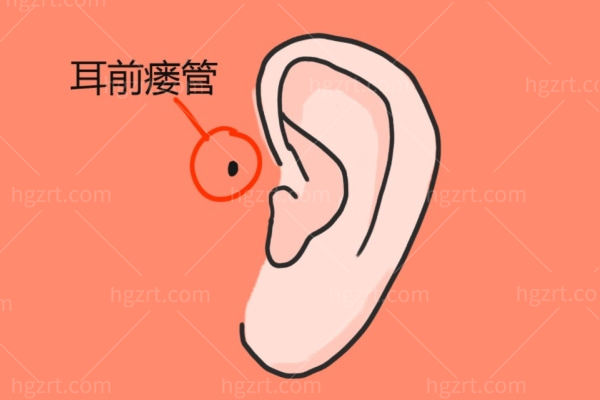 小耳畸形可以报销吗