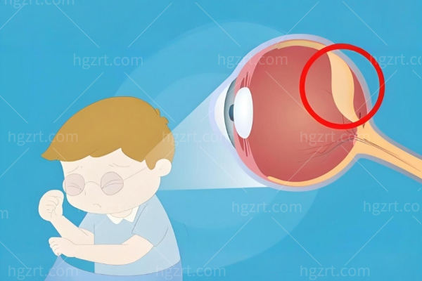 视网膜脱落取油后几天复原视力?为什么取油后视力复原不能急?视网膜脱落医院名单大揭秘