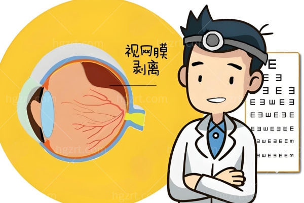 视网膜脱落取油后几天复原视力?为什么取油后视力复原不能急?视网膜脱落医院名单大揭秘