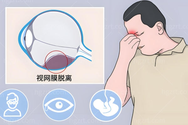 视网膜脱落取油后几天复原视力?为什么取油后视力复原不能急?视网膜脱落医院名单大揭秘