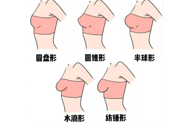 人工韧带提胸哪里可以做?人工韧带提胸术会凹凸不平吗?能维持多久?