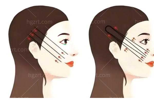 重庆李喆整形医生简介