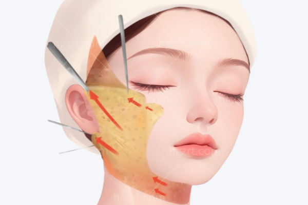 重庆李喆整形医生简介