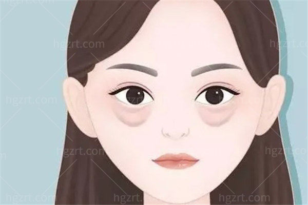 无-创祛眼袋会反弹吗