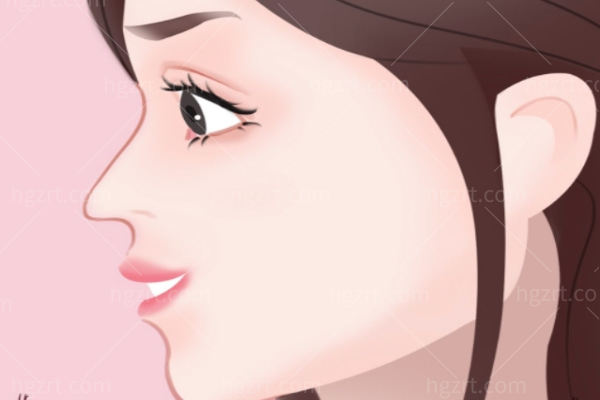 李鸿君做鼻子多少钱