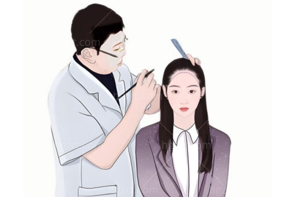 深圳碧莲盛植发技术优势有哪些