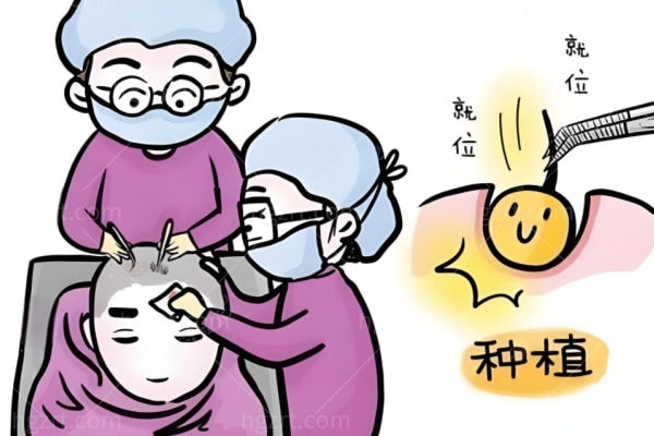 24小时植发在线预约挂号极速通道：告别脱发焦虑，轻松重启浓密秀发！