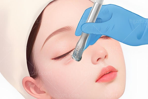 卧蚕填充前后对比照片的病例:卧蚕用什么填充好?眼袋肿成蛋袋了,急救消肿指南