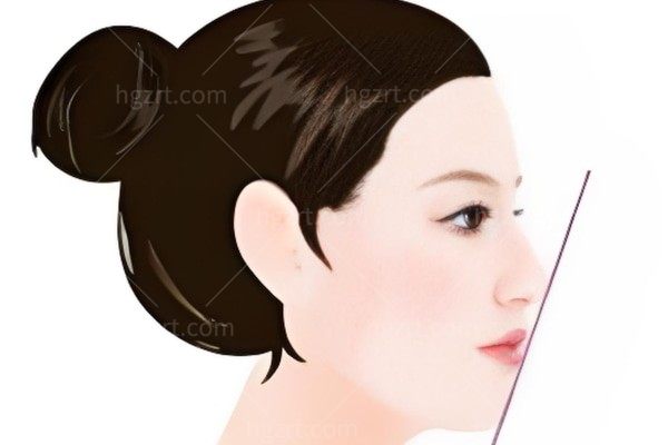 想隆鼻，直鼻和直鼻微翘哪个带眼镜好看？