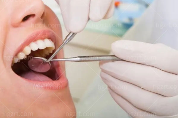 牙齿龋坏有什么症状?龋坏达牙本质中层是什么龋?尽早抓住补牙黄金窗口期