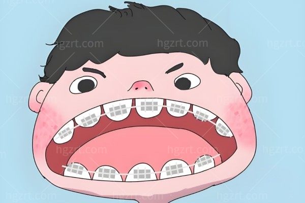 7岁换牙期做矫正，是不是黄金时机？