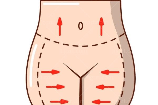 做的大腿环吸黄金微雕手术出现松垮、坑洼现象，做吸脂失败修复手术有用吗？