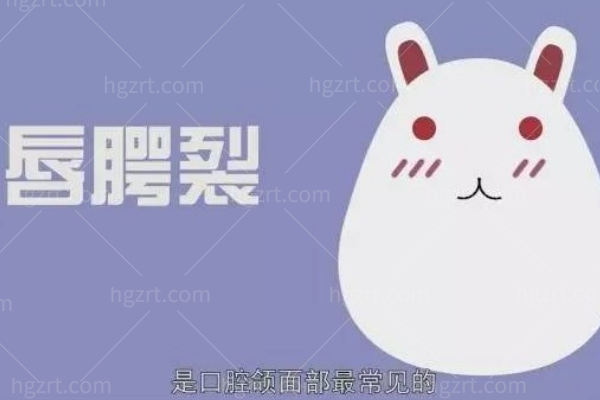 唇腭裂二次修复手术免费吗
