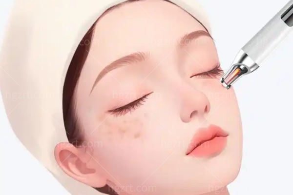 上海做皮秒激光哪家医院好?艺星/时光/华美/美莱/仁爱扒一扒上海热门医院的真实优势