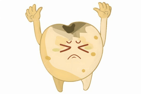 激光补牙和普通补牙哪个好?激光补牙是什么原理?能维持多久?