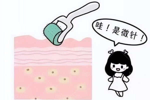 香港打童颜针多少钱？2025全新价格表+避坑指南