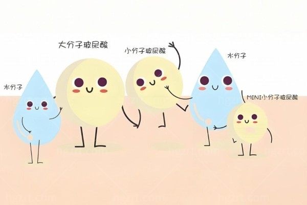 医佳妍玻尿酸多少钱一支?国产高性价比之选,1980元起塑美颜维持6到12个月